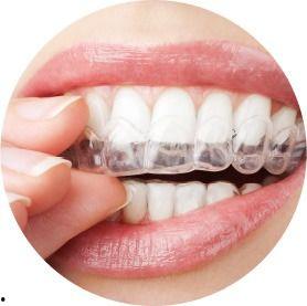 隐形牙套国产经历视频